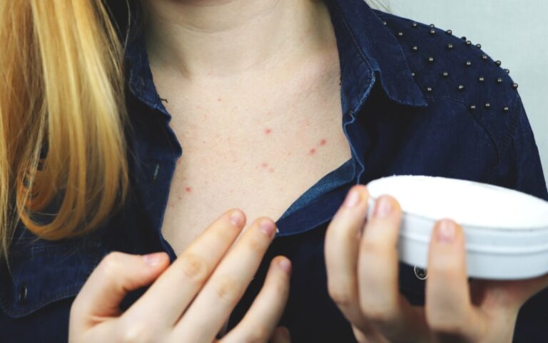 Kolonya Uyuza İyi Gelir mi?