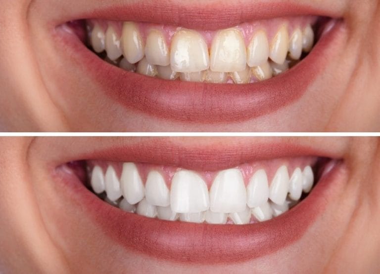 İmplant ve Estetik Diş Çözümlerinde Doğru Adres